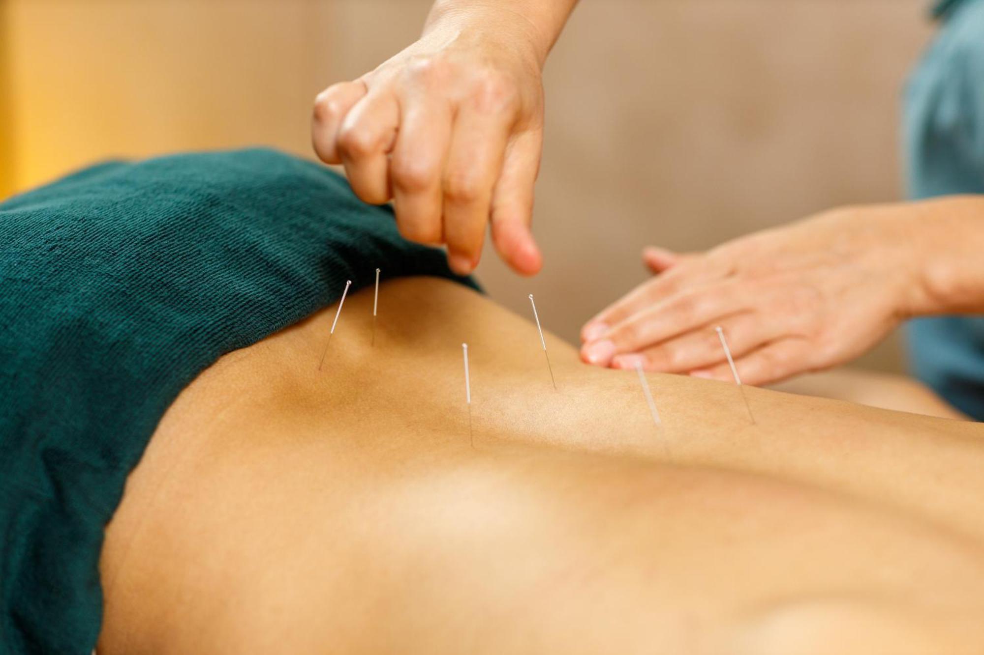 Angkor Grace Wellness Resort Σιέμ Ρέαπ Εξωτερικό φωτογραφία